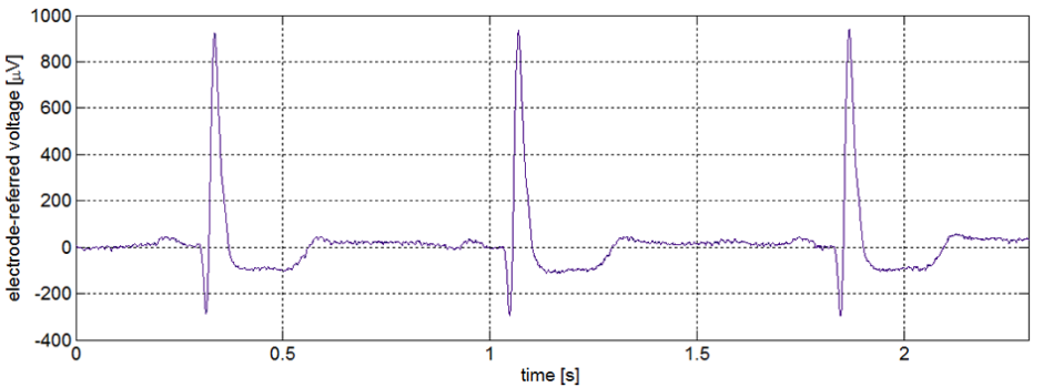 ECG from Intan RHD2000 chip